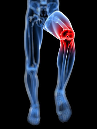 膝の痛みイメージ図